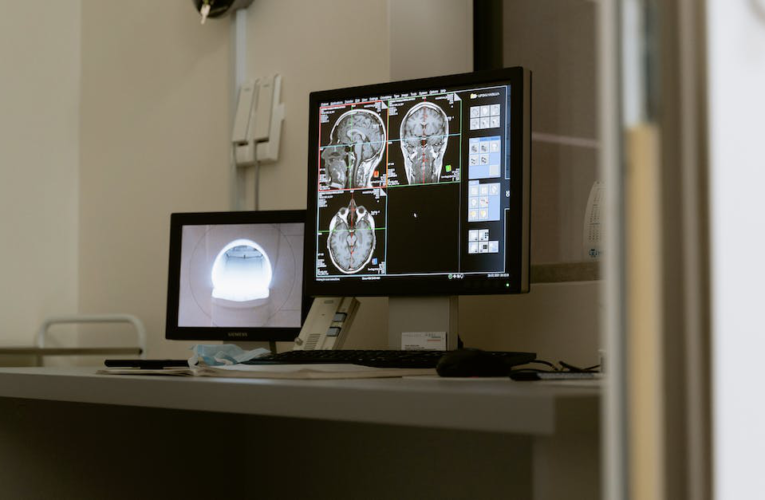 Czas oczekiwania na wynik rezonansu magnetycznego głowy – ile to trwa?