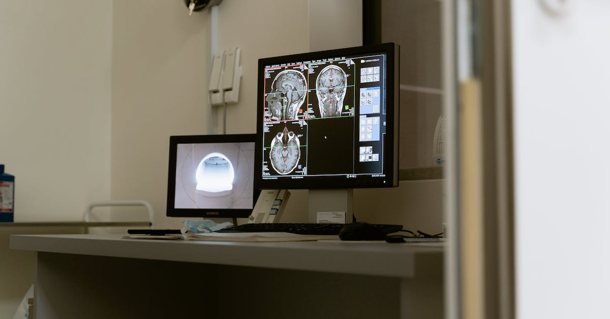 Czas oczekiwania na wynik rezonansu magnetycznego głowy - ile to trwa?